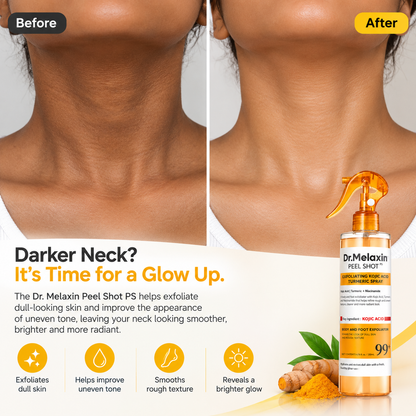 Dr. Melaxin Peel Shot PS Exfoliating Kojic Acid Turmeric Spray